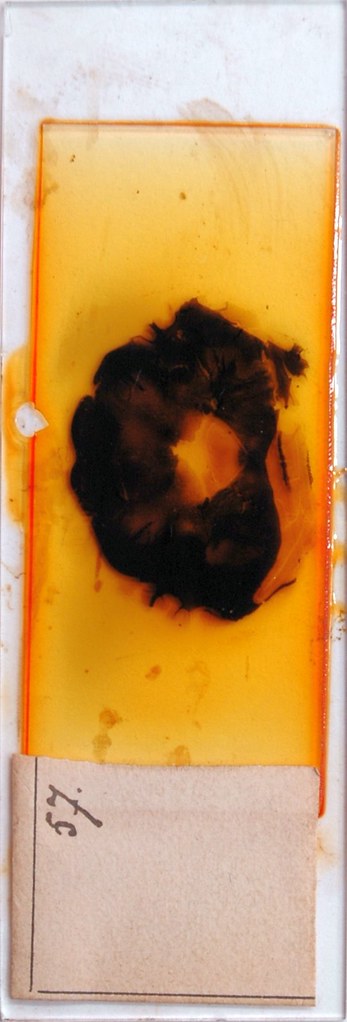 Sherrington's Box Drawer 4, Row 3, Slide 57