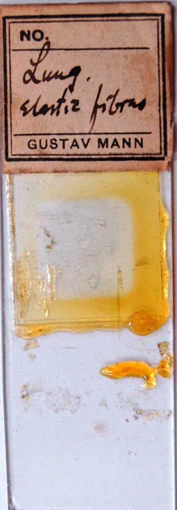 Sherrington's Box Drawer 18, Row 3, Slide 12