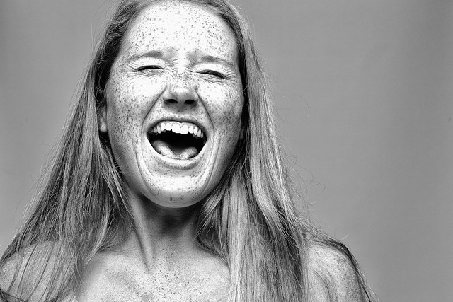 Freckles 03